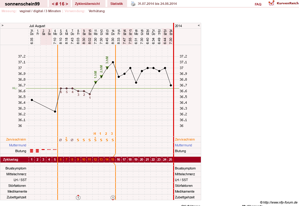 NFP-Kurve User #17031