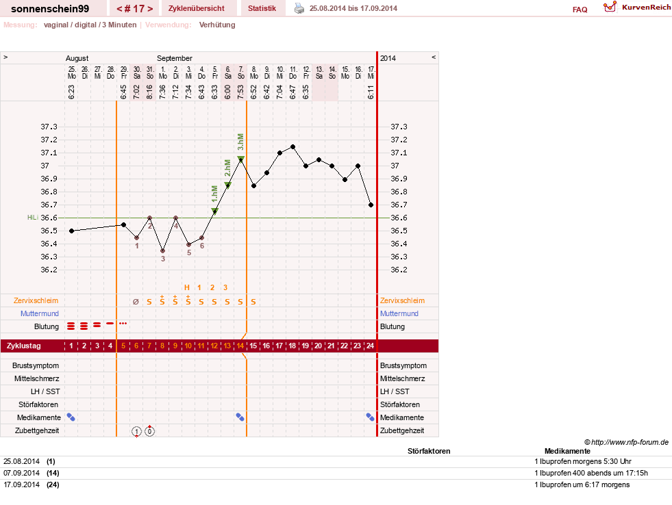 NFP-Kurve User #17031