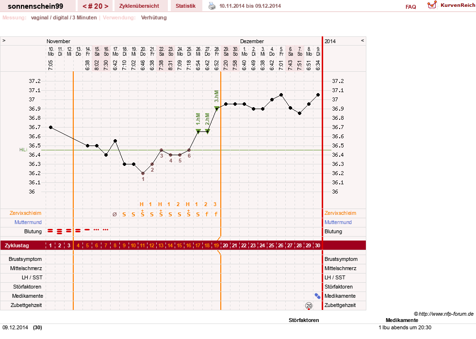 NFP-Kurve User #17031