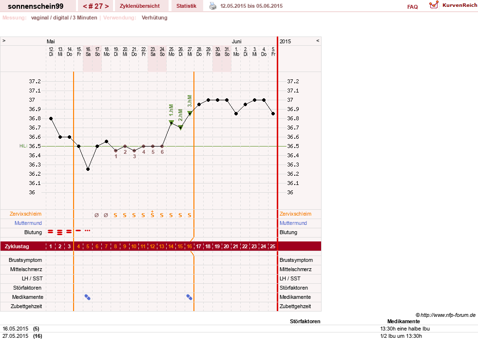 NFP-Kurve User #17031