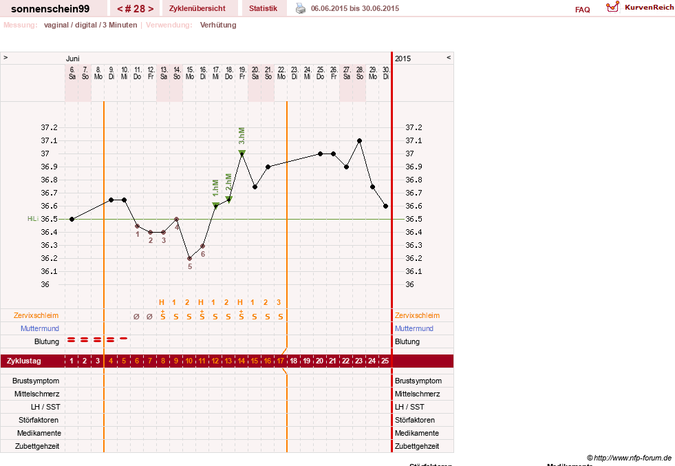 NFP-Kurve User #17031