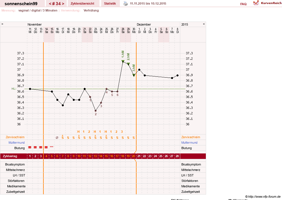 NFP-Kurve User #17031