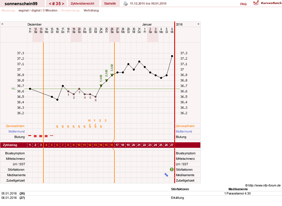 NFP-Kurve User #17031