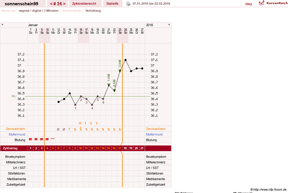 NFP-Kurve User #17031