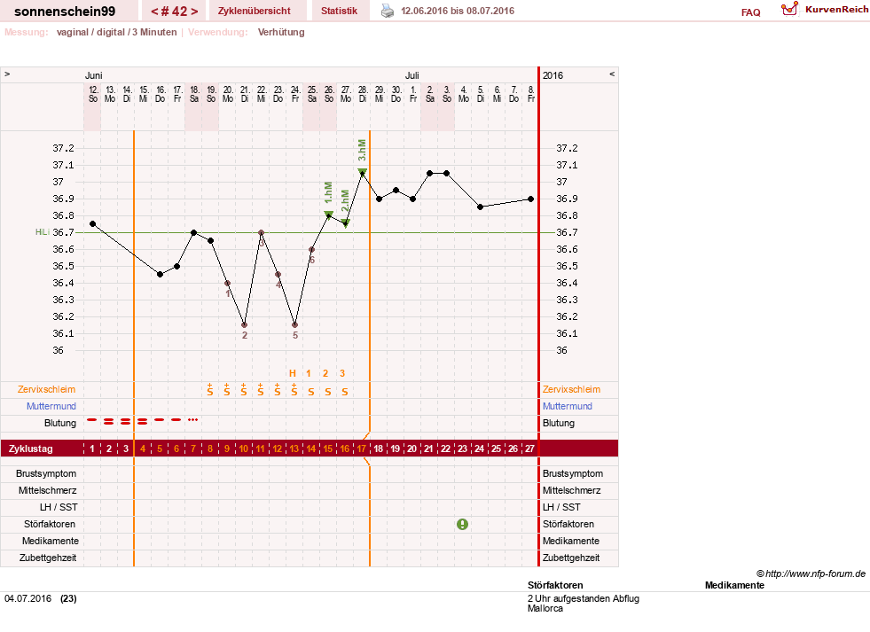 NFP-Kurve User #17031