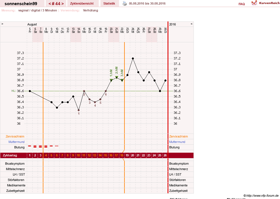 NFP-Kurve User #17031