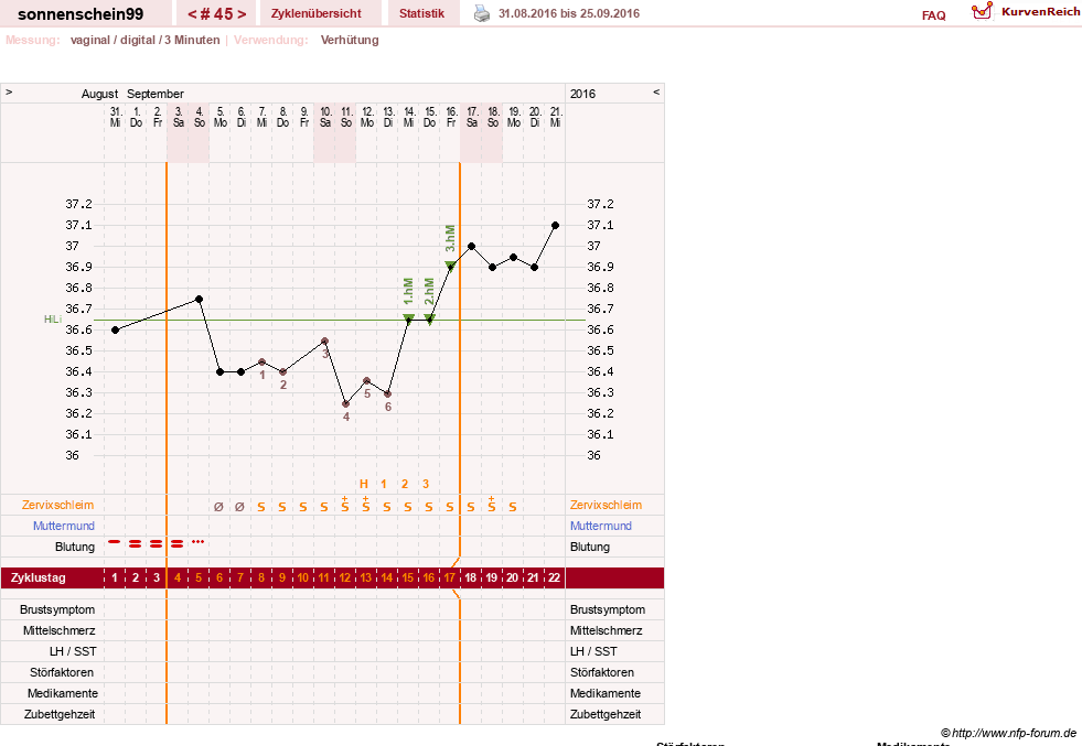NFP-Kurve User #17031