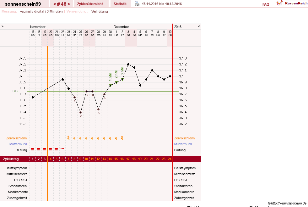 NFP-Kurve User #17031
