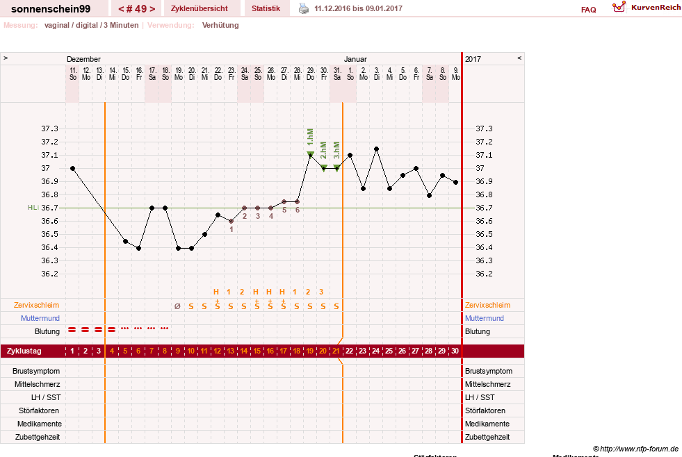 NFP-Kurve User #17031