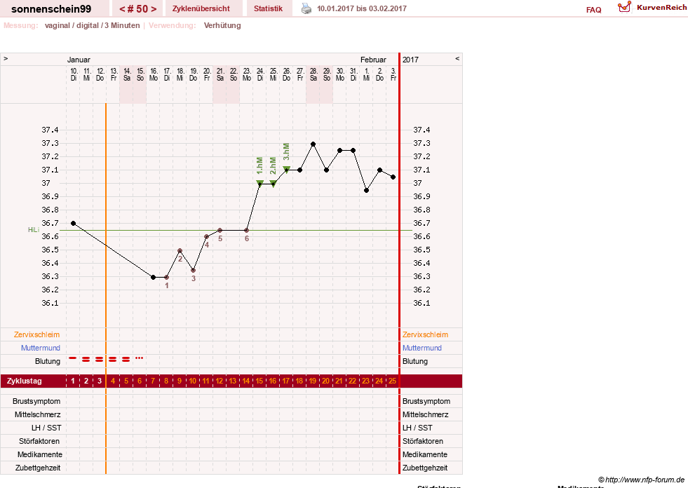 NFP-Kurve User #17031
