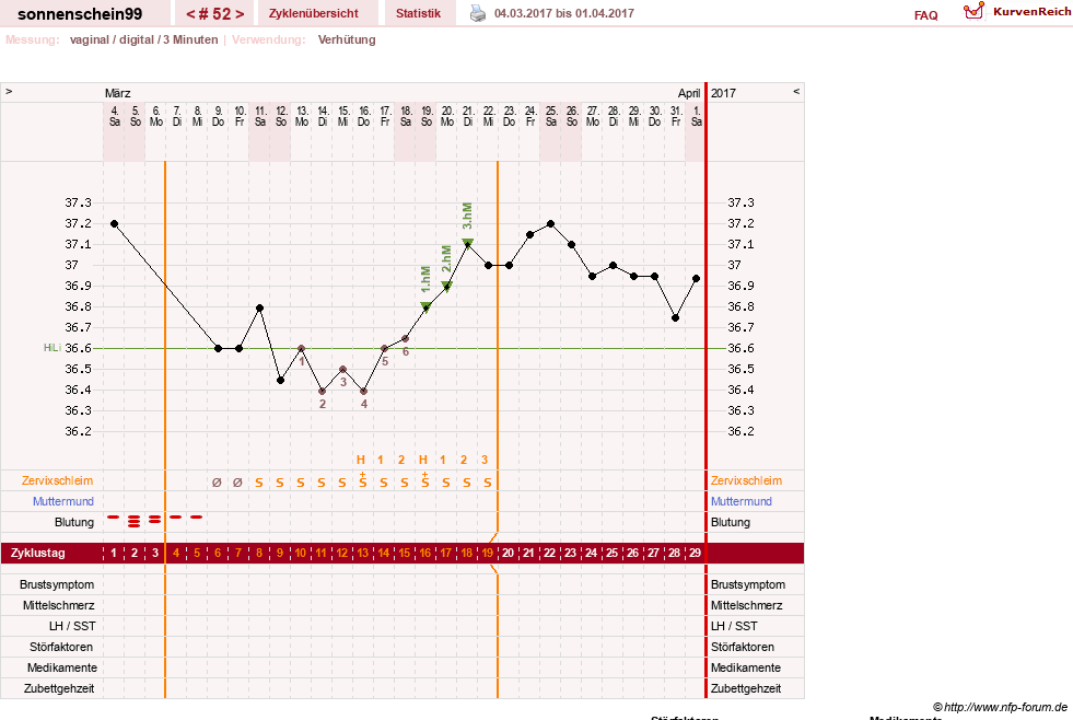 NFP-Kurve User #17031