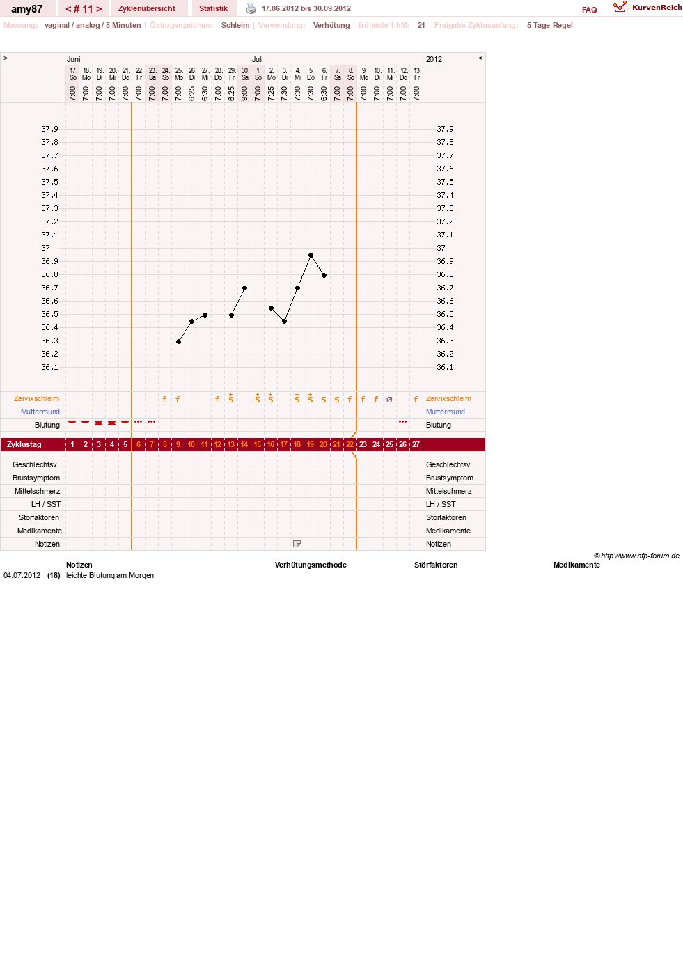 NFP-Kurve User #17080