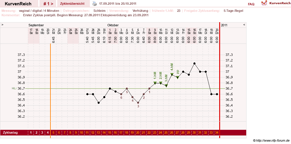 NFP-Kurve User #17246