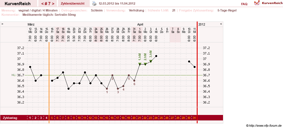 NFP-Kurve User #17246