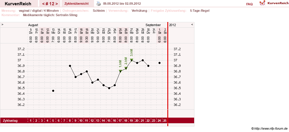 NFP-Kurve User #17246