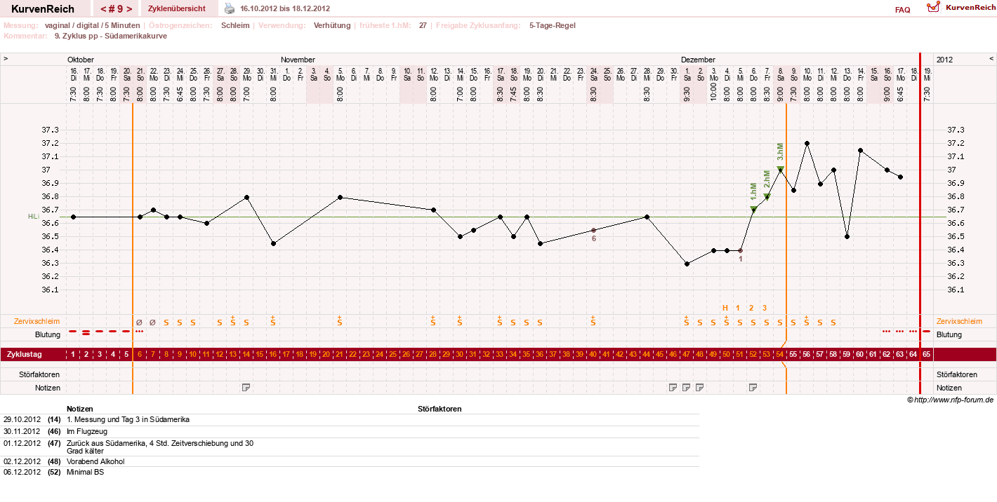 NFP-Kurve User #17366