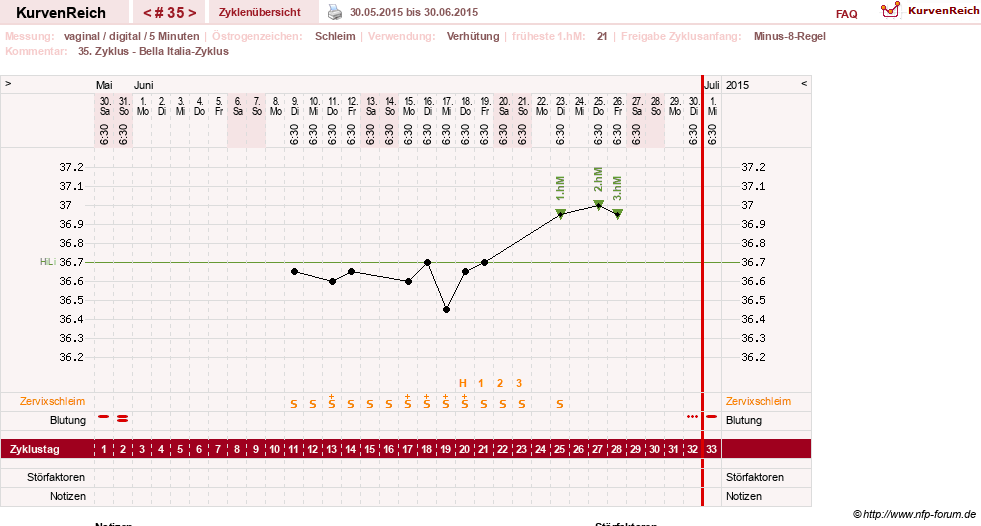 NFP-Kurve User #17366