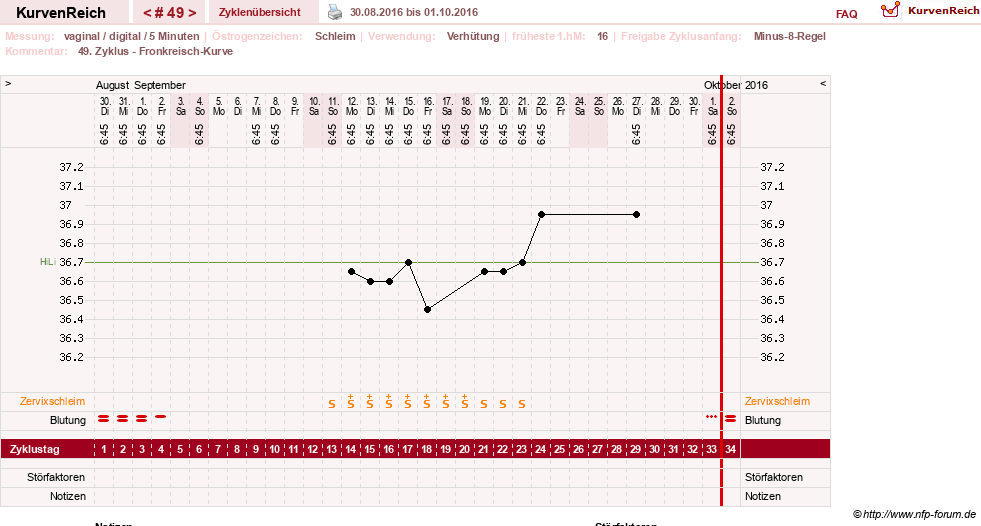 NFP-Kurve User #17366