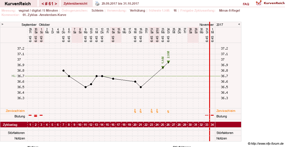 NFP-Kurve User #17366