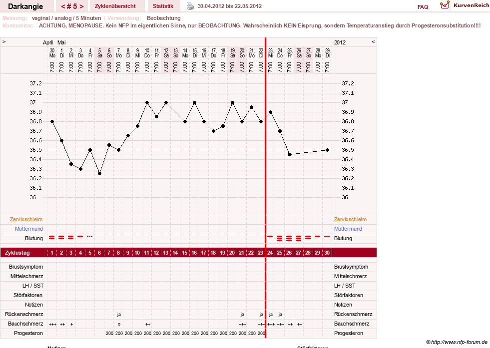 NFP-Kurve User #17386