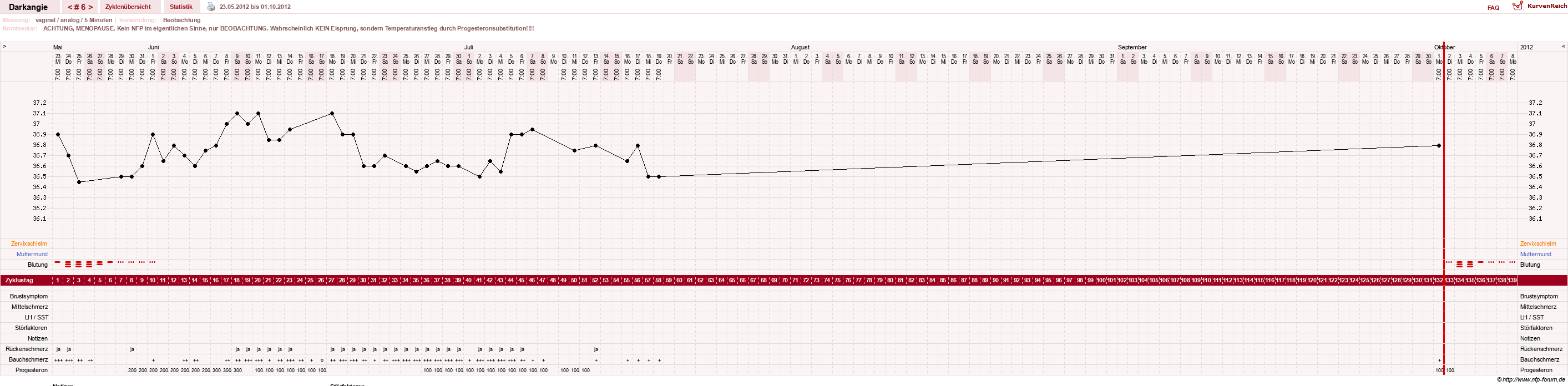 NFP-Kurve User #17386