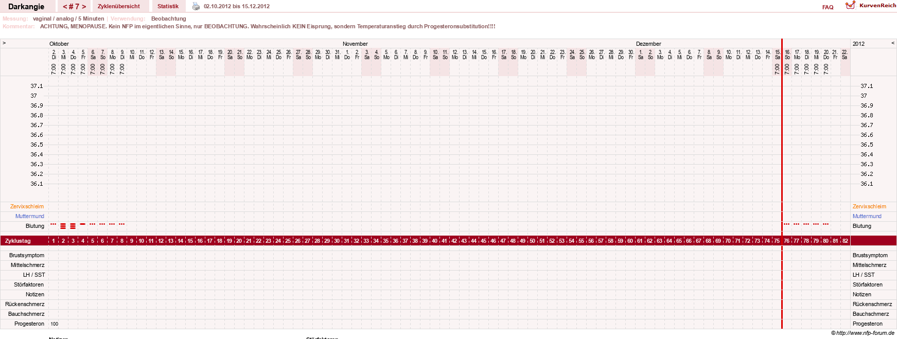 NFP-Kurve User #17386