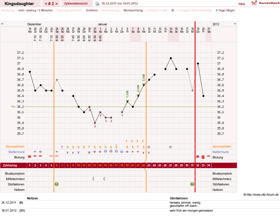 NFP-Kurve User #17540