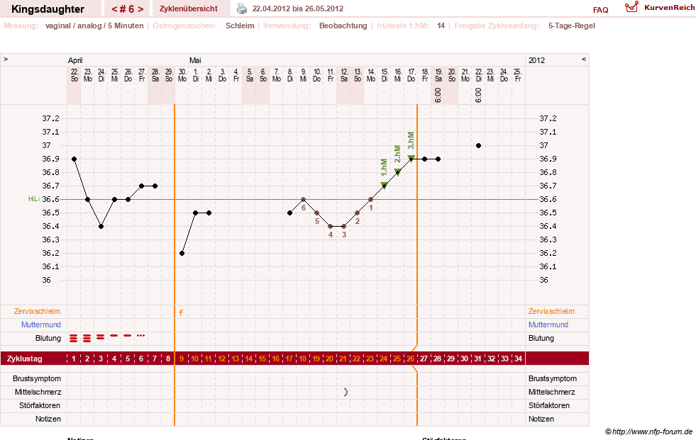 NFP-Kurve User #17540
