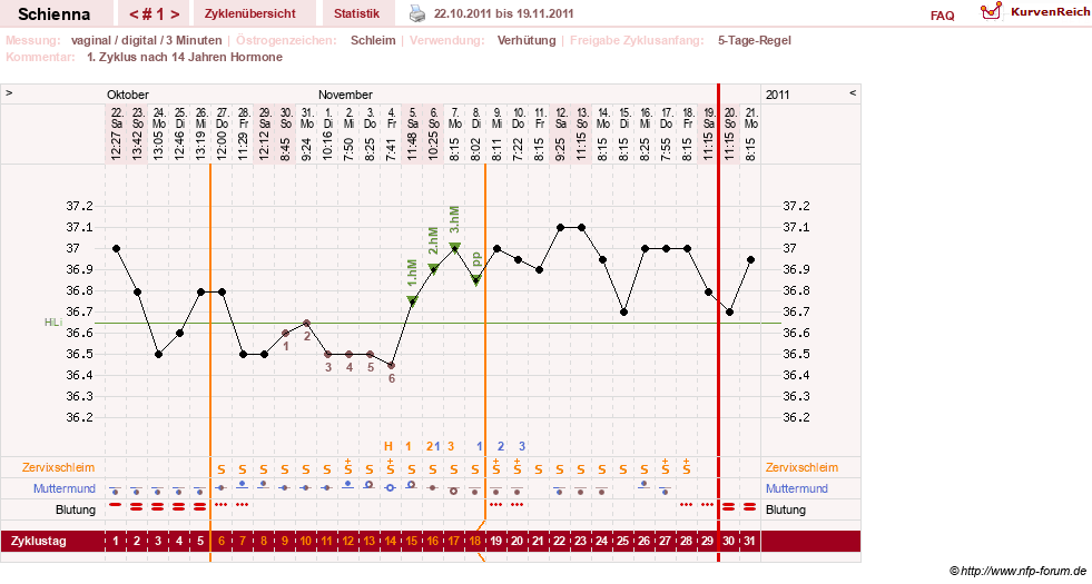 NFP-Kurve User #17563