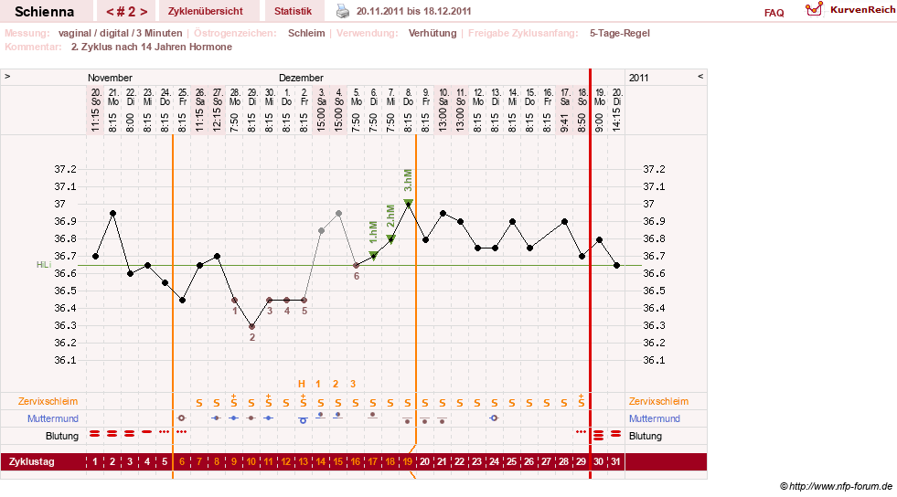 NFP-Kurve User #17563