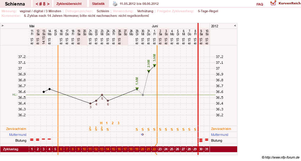 NFP-Kurve User #17563