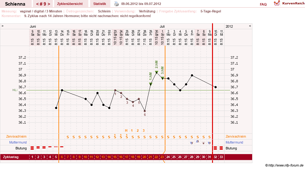 NFP-Kurve User #17563