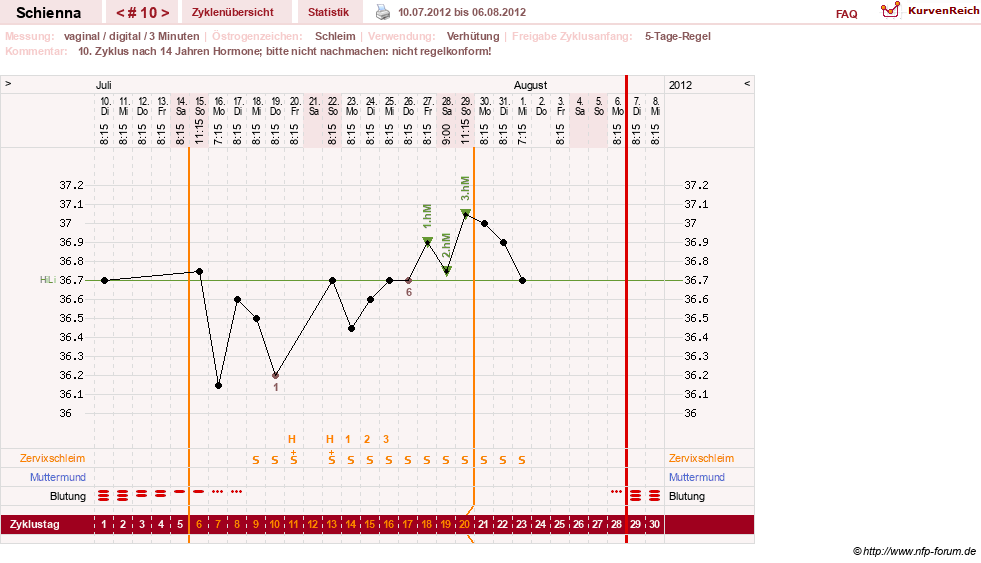 NFP-Kurve User #17563