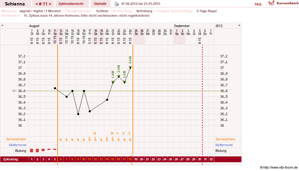 NFP-Kurve User #17563
