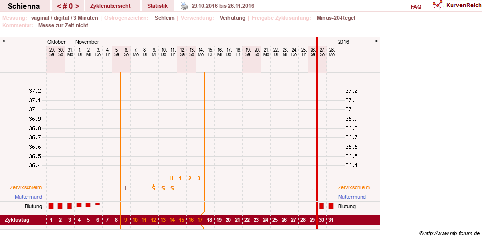 NFP-Kurve User #17563
