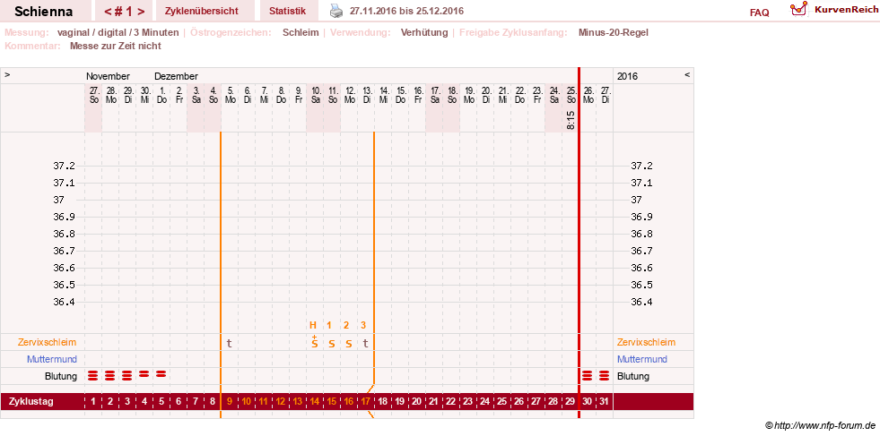 NFP-Kurve User #17563