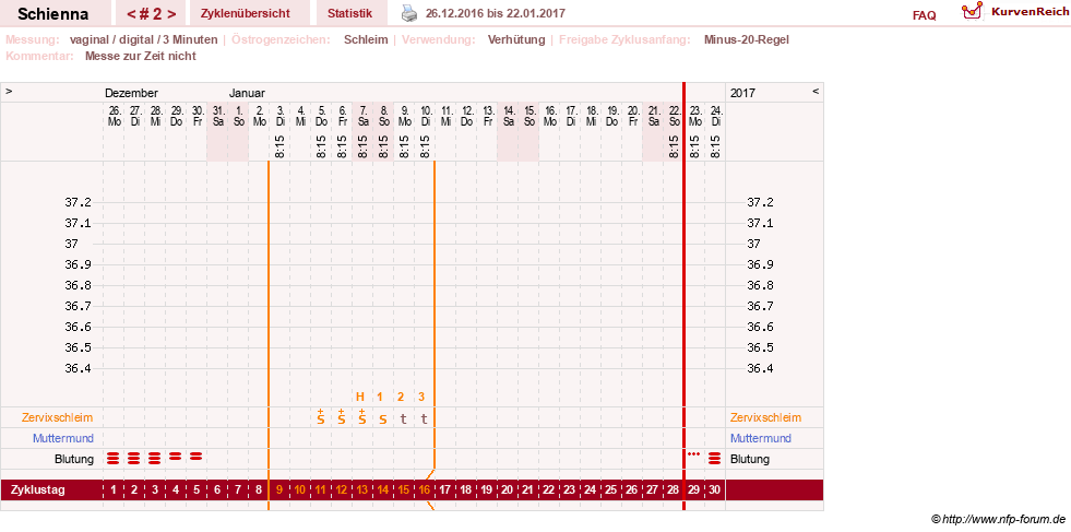 NFP-Kurve User #17563