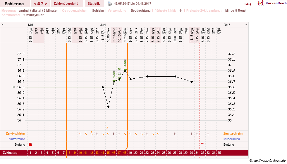 NFP-Kurve User #17563