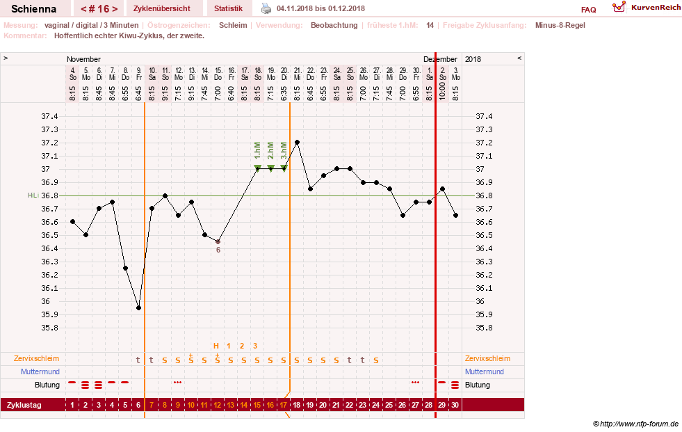 NFP-Kurve User #17563