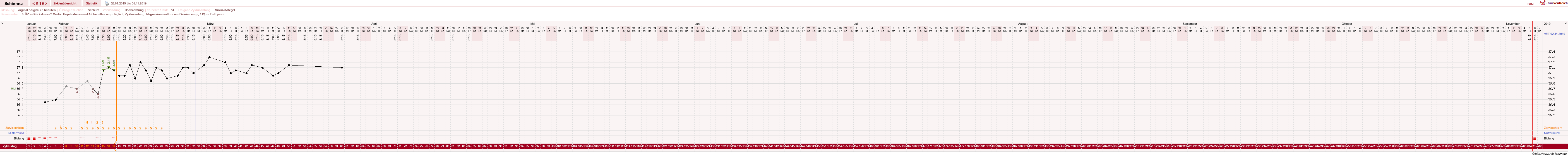NFP-Kurve User #17563