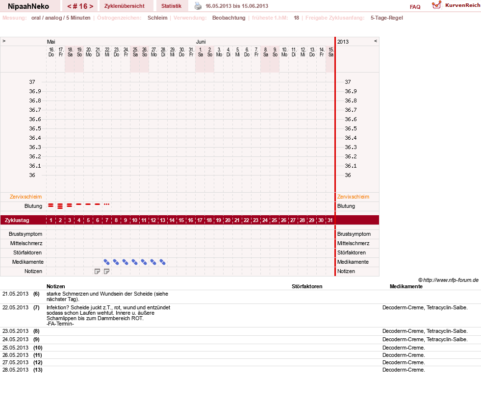 NFP-Kurve User #17629