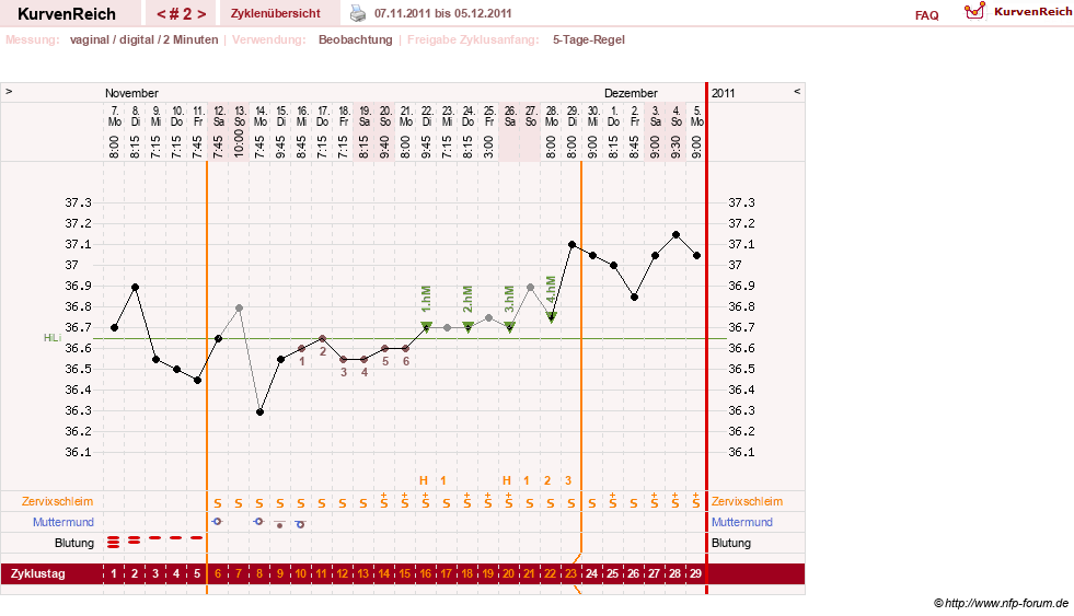 NFP-Kurve User #17633