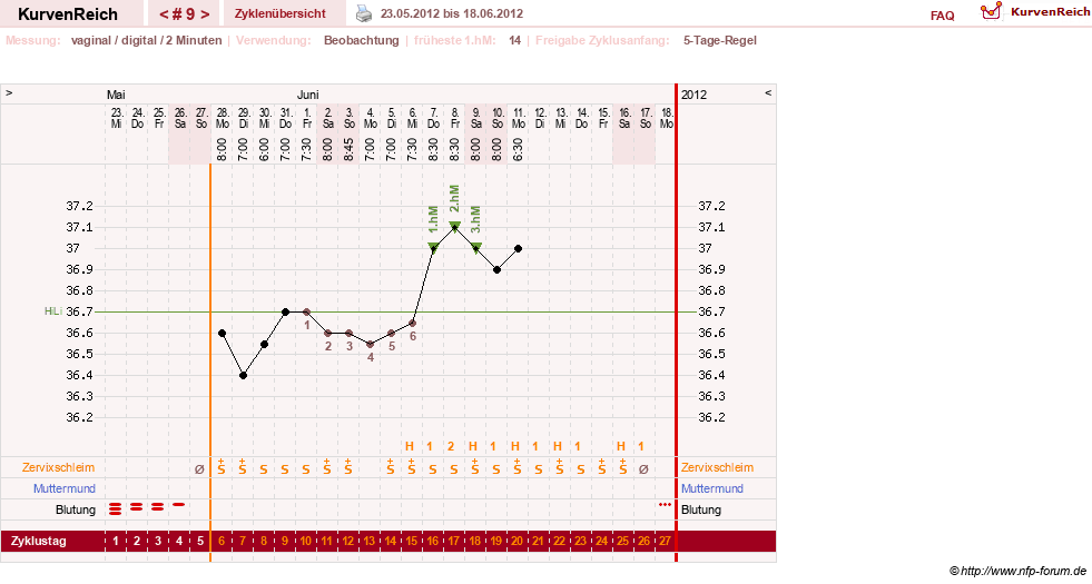 NFP-Kurve User #17633