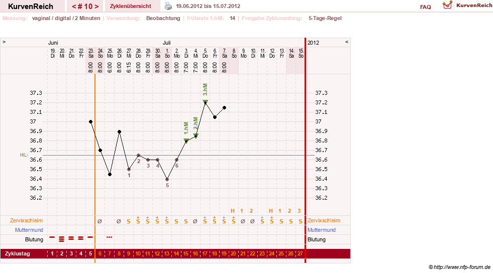 NFP-Kurve User #17633