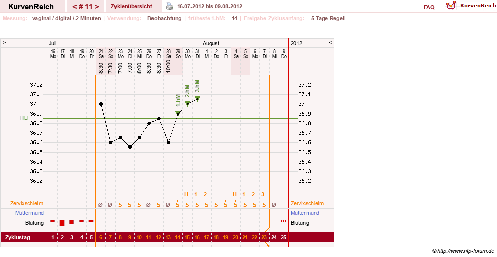 NFP-Kurve User #17633