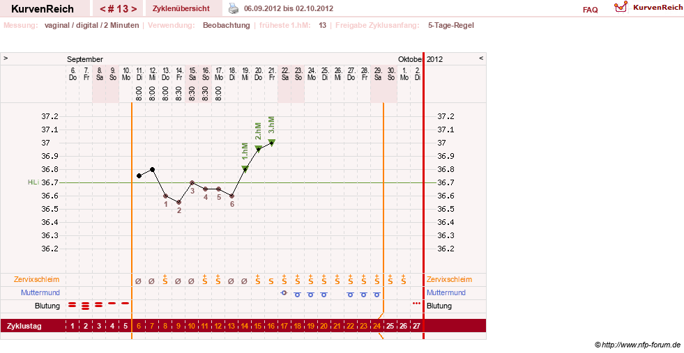 NFP-Kurve User #17633