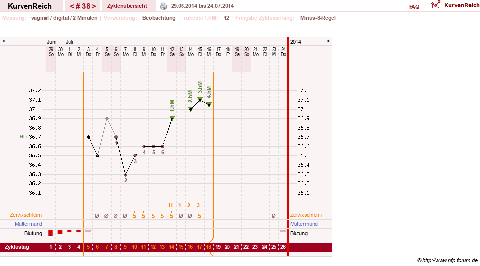 NFP-Kurve User #17633