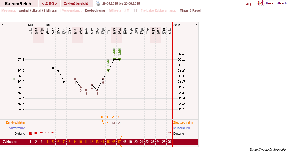 NFP-Kurve User #17633