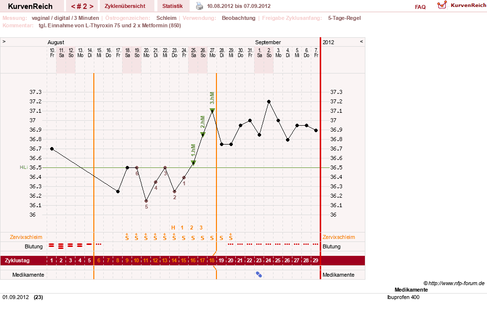 NFP-Kurve User #17672