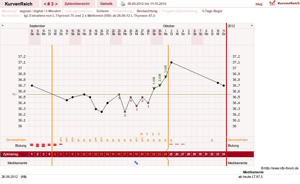 NFP-Kurve User #17672